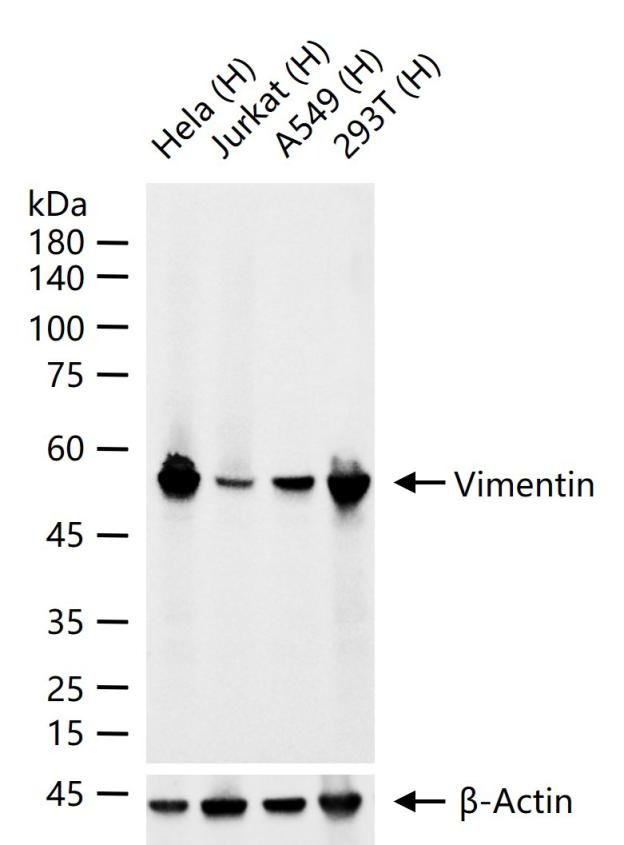 Anti-Vimentin Antibody (3C354)
