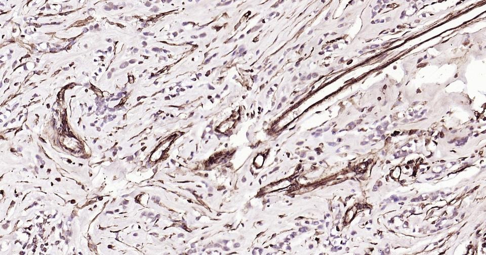 Anti-Vimentin Polyclonal Antibody