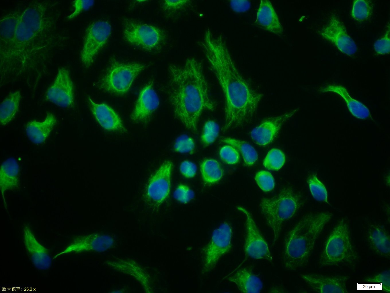 Anti-Vimentin Polyclonal Antibody