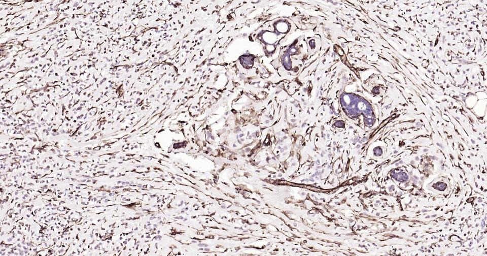 Anti-Vimentin Polyclonal Antibody 3