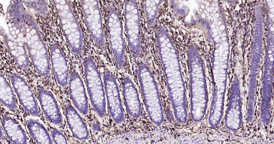 Anti-Vimentin Polyclonal Antibody