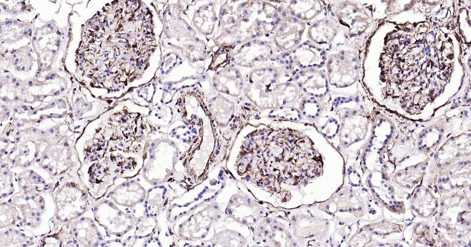 Anti-Vimentin Polyclonal Antibody