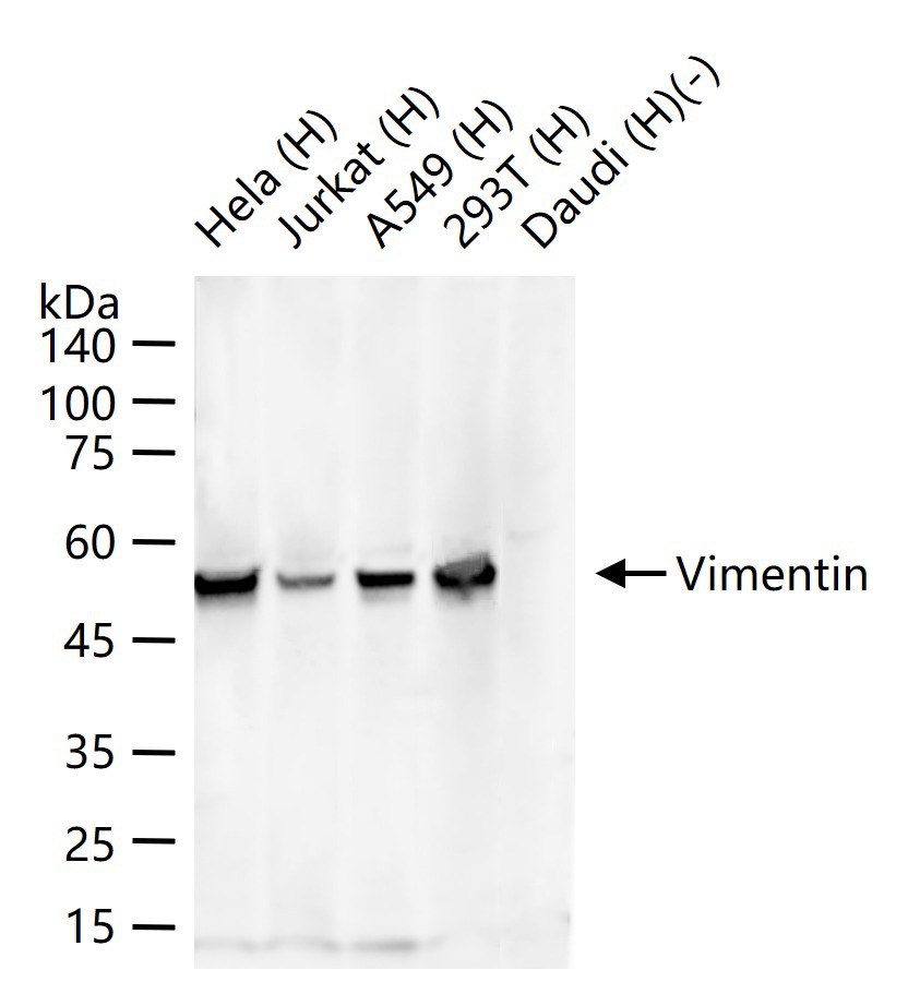 Anti-Vimentin Polyclonal Antibody 2