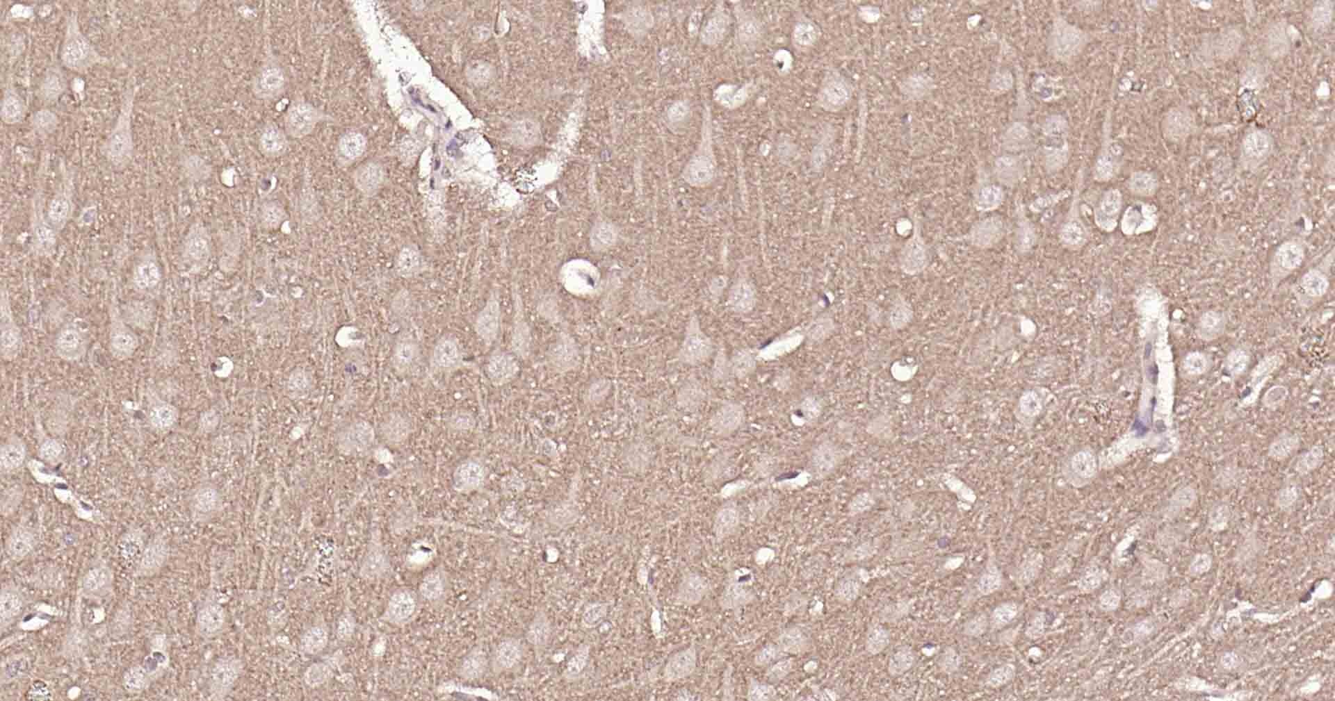 Anti-VGLUT1/BNP1 Polyclonal Antibody