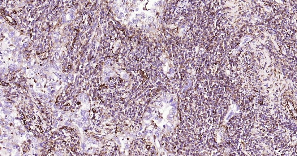 Anti-Vimentin Polyclonal Antibody 2