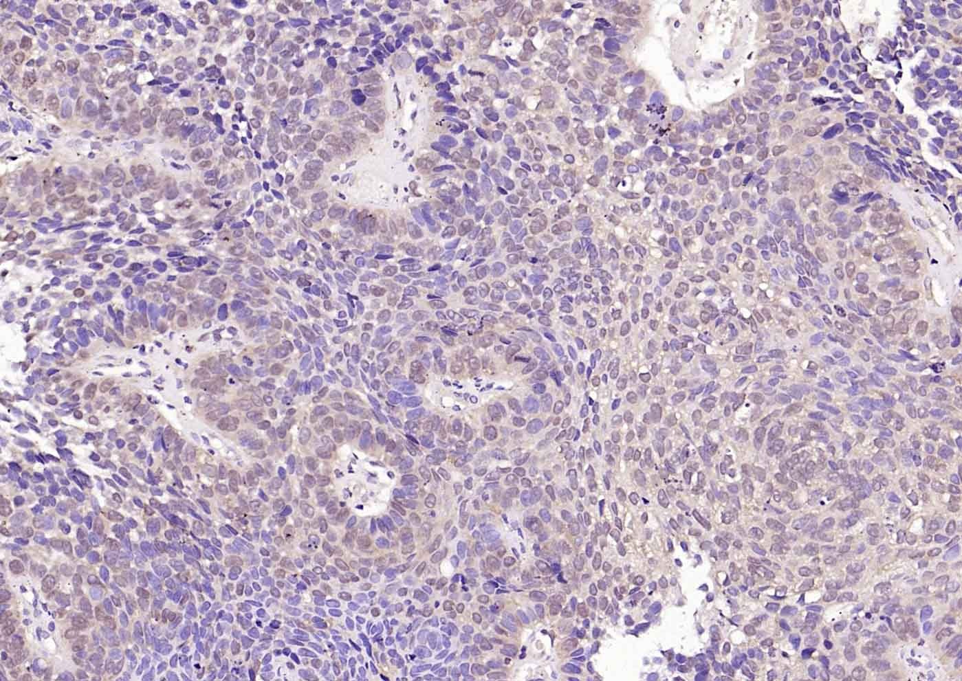 Anti-VEGFR3/FLT4 Polyclonal Antibody