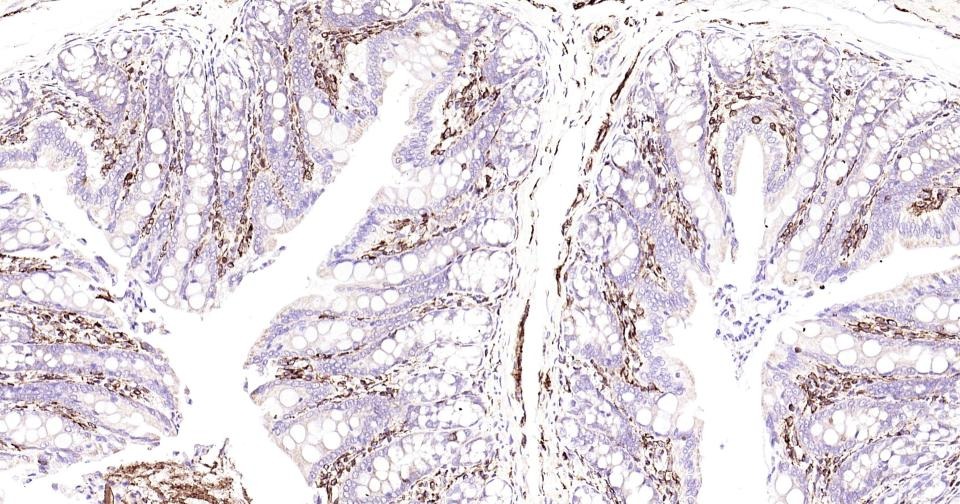 Anti-Vimentin Polyclonal Antibody