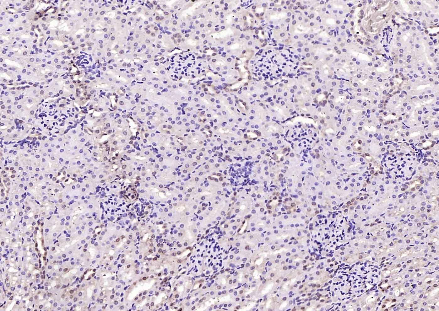 Anti-VEGFR3/FLT4 Polyclonal Antibody