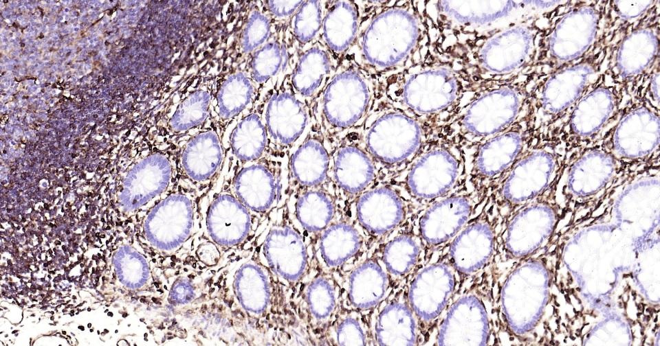 Anti-Vimentin Antibody (3C354)