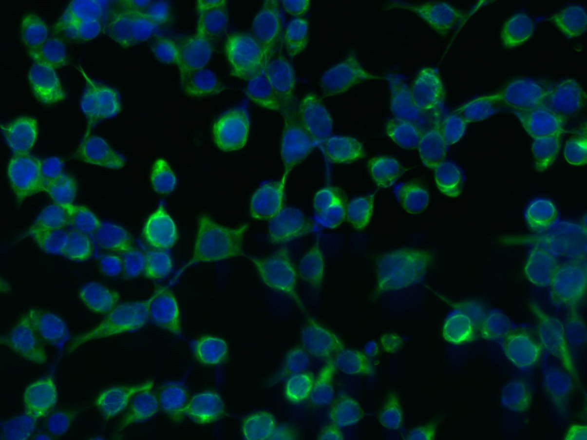 Anti-Vimentin Polyclonal Antibody 3