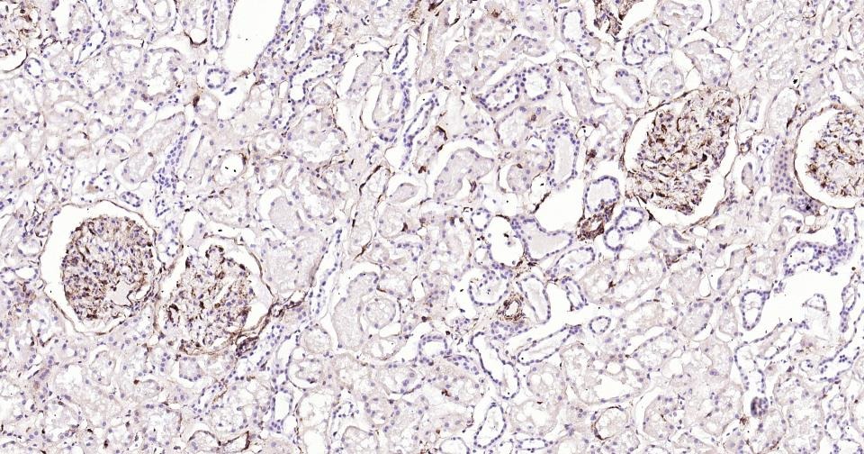 Anti-Vimentin Polyclonal Antibody 3