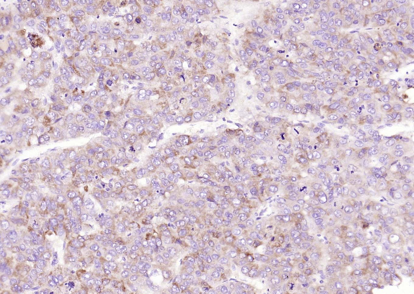 Anti-VEGFR1/FLT-1 Polyclonal Antibody