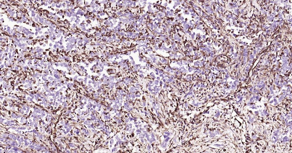 Anti-Vimentin Polyclonal Antibody 2
