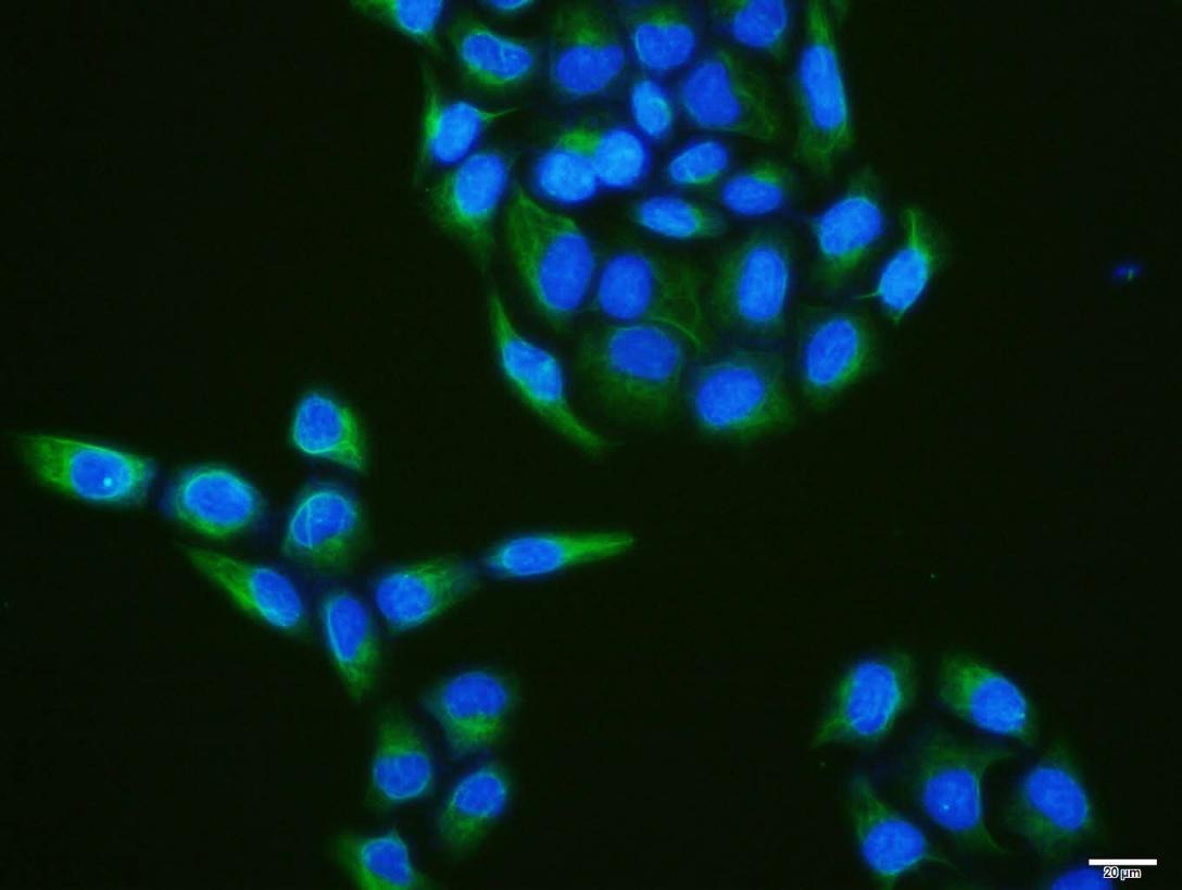 Anti-Vimentin Polyclonal Antibody 2
