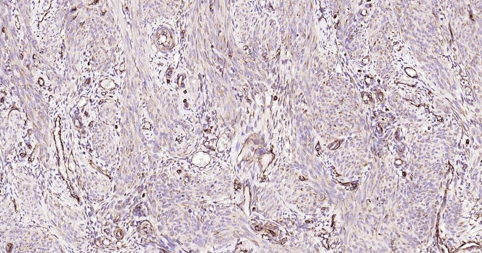 Anti-Vimentin Polyclonal Antibody