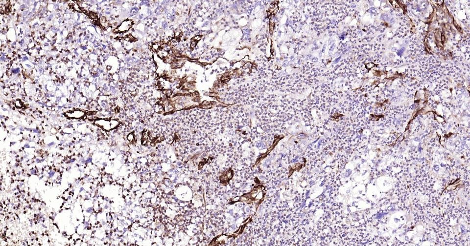Anti-Vimentin Polyclonal Antibody 3