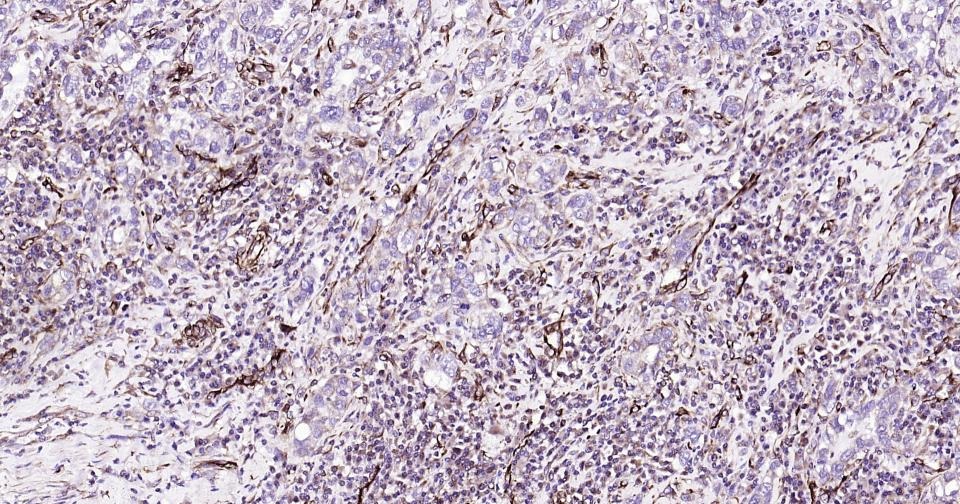 Anti-Vimentin Polyclonal Antibody