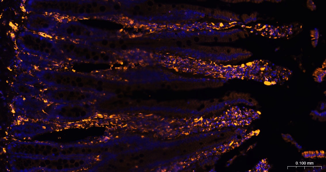Anti-Vimentin Polyclonal Antibody 3
