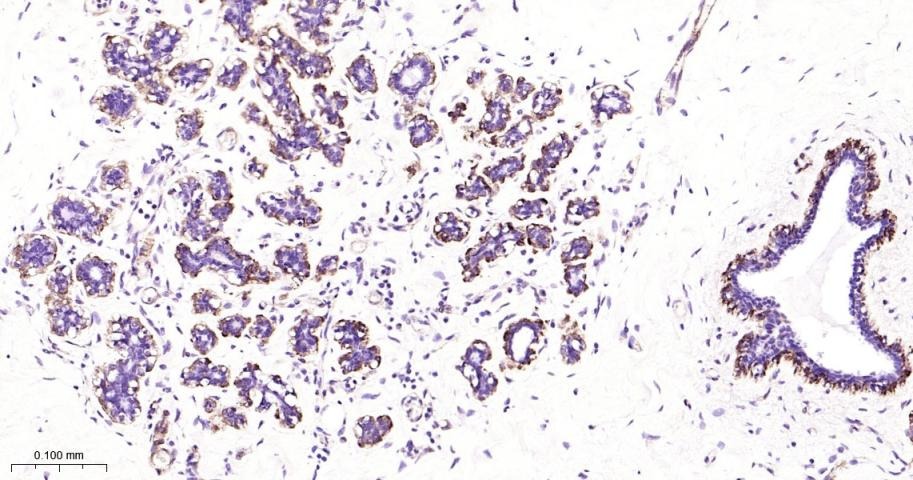 Vinculin Loading Control Antibody (5P889)