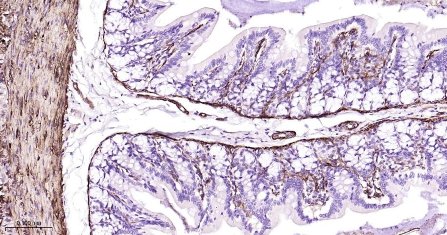 Vinculin Loading Control Antibody (5P889)