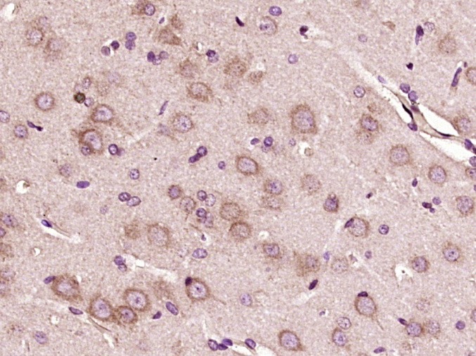 Anti-Von Willebrand Factor/vWF Polyclonal Antibody 2
