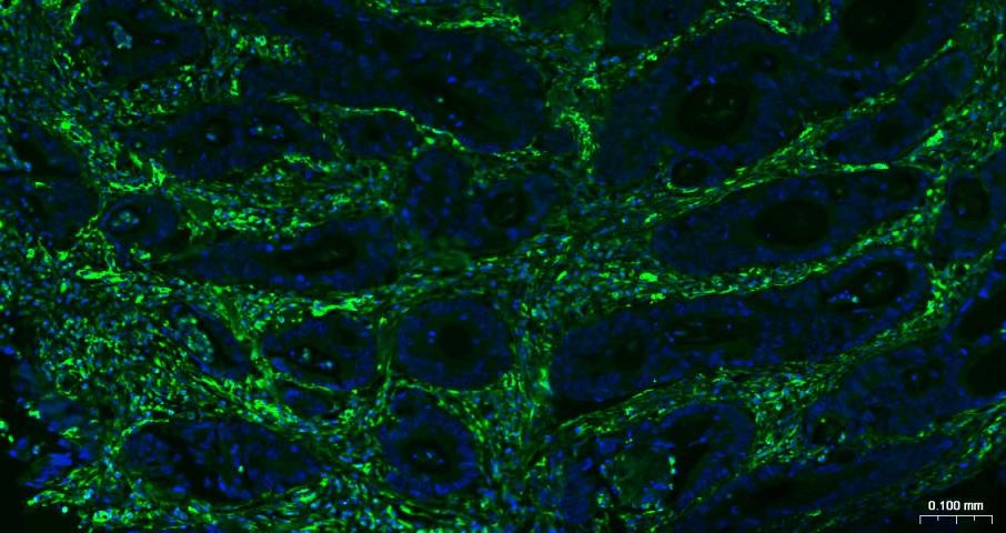 Anti-Vimentin Polyclonal Antibody 3