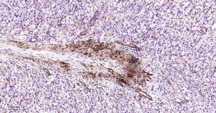 Vinculin Loading Control Antibody (5P889)