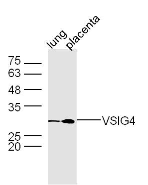 Anti-VSIG4 Polyclonal Antibody
