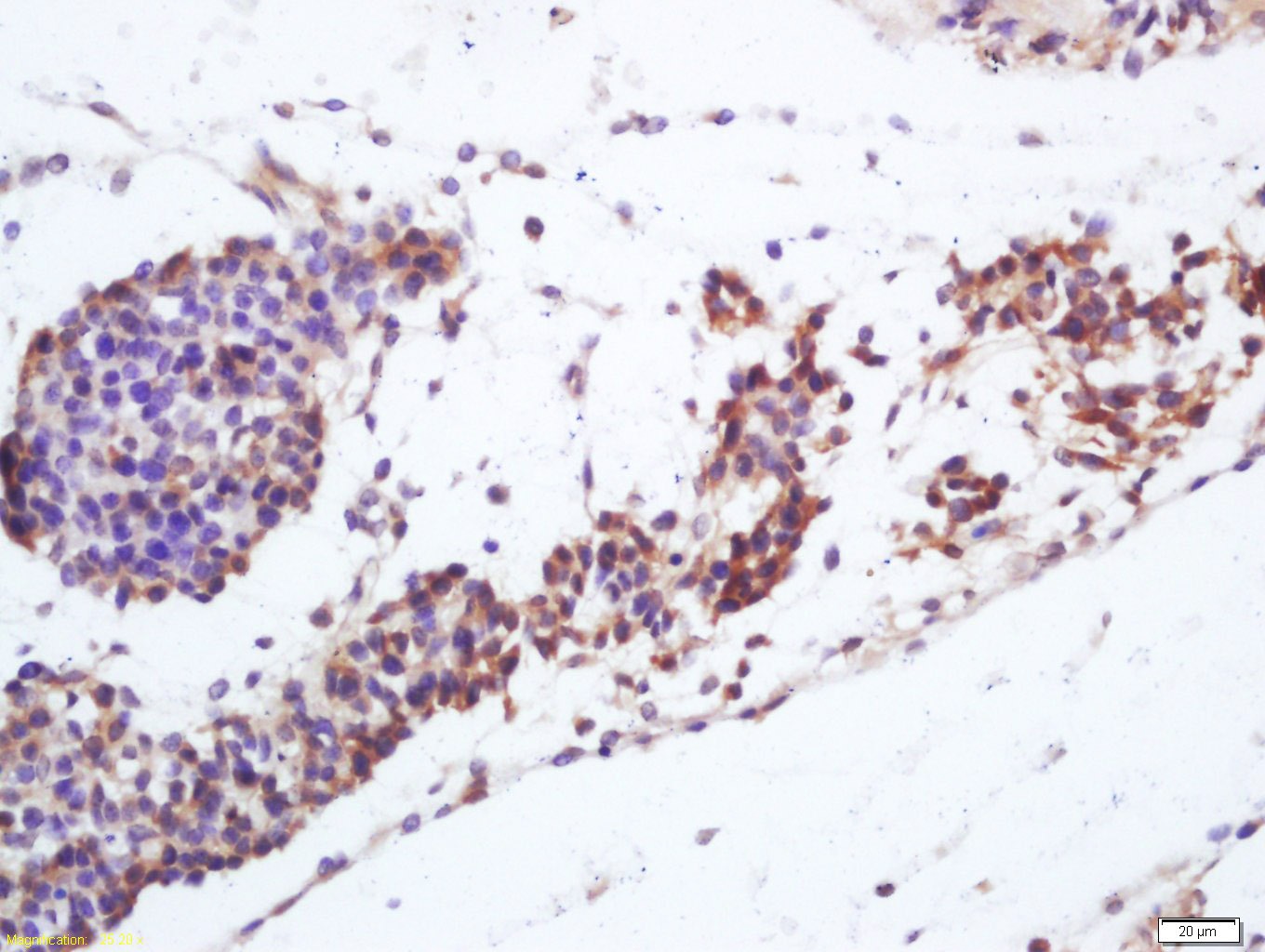 Anti-Vitamin D Receptor/VDR Polyclonal Antibody