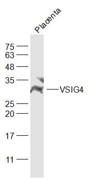 Anti-VSIG4 Polyclonal Antibody
