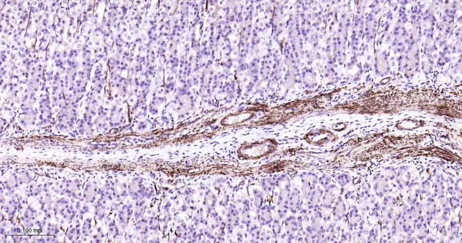 Vinculin Loading Control Antibody (5P889)