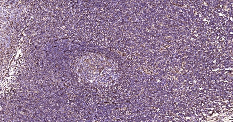 Anti-Vimentin Polyclonal Antibody 3