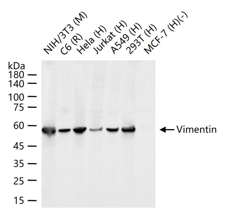 Anti-Vimentin Polyclonal Antibody 3