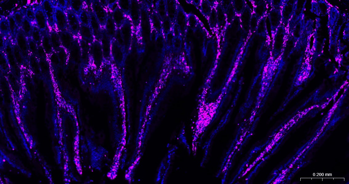 Anti-Vimentin Polyclonal Antibody 3