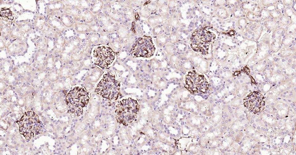 Anti-Vimentin Polyclonal Antibody 3