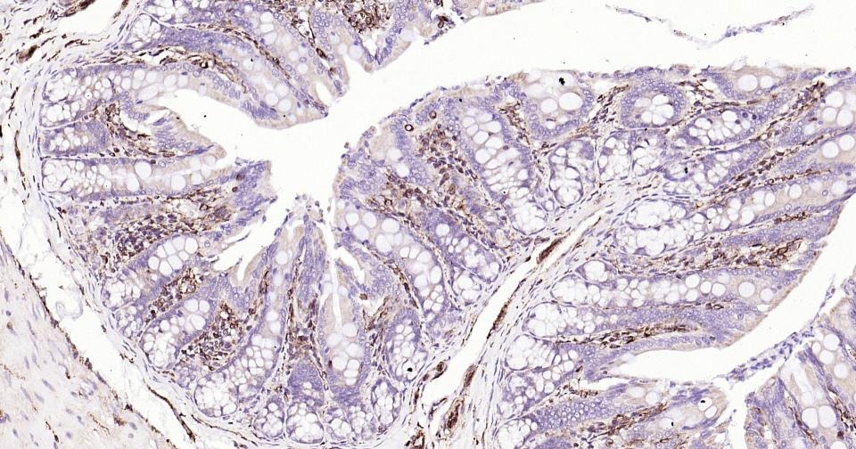 Anti-Vimentin Polyclonal Antibody 3