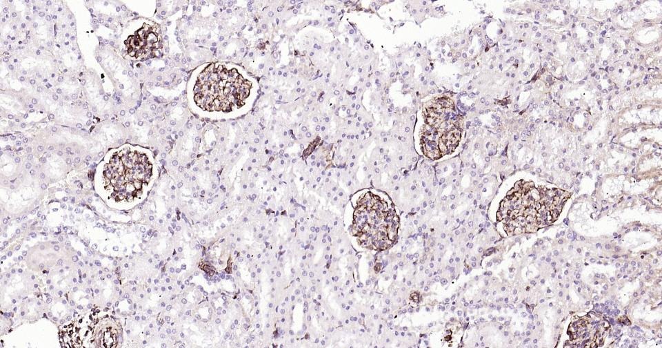 Anti-Vimentin Polyclonal Antibody 3