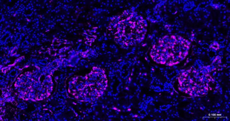 Anti-Vimentin Polyclonal Antibody 3