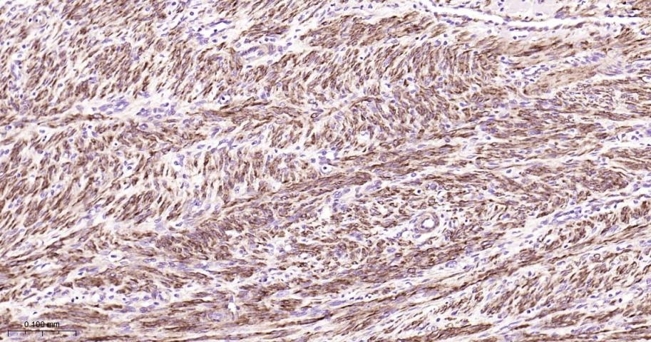 Vinculin Loading Control Antibody (5P889)