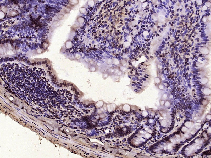 Anti-Vitamin D Receptor/VDR Polyclonal Antibody 2