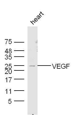 Anti-VEGFA Polyclonal Antibody