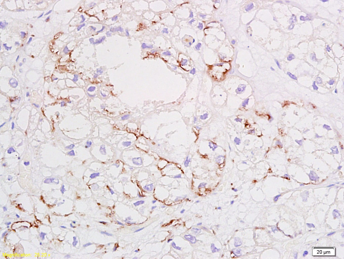 Anti-VEGFA Polyclonal Antibody 2