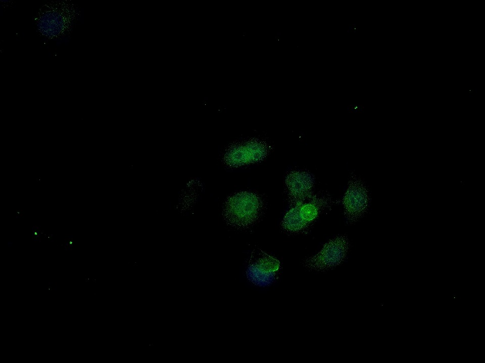 Anti-YAP1 Polyclonal Antibody