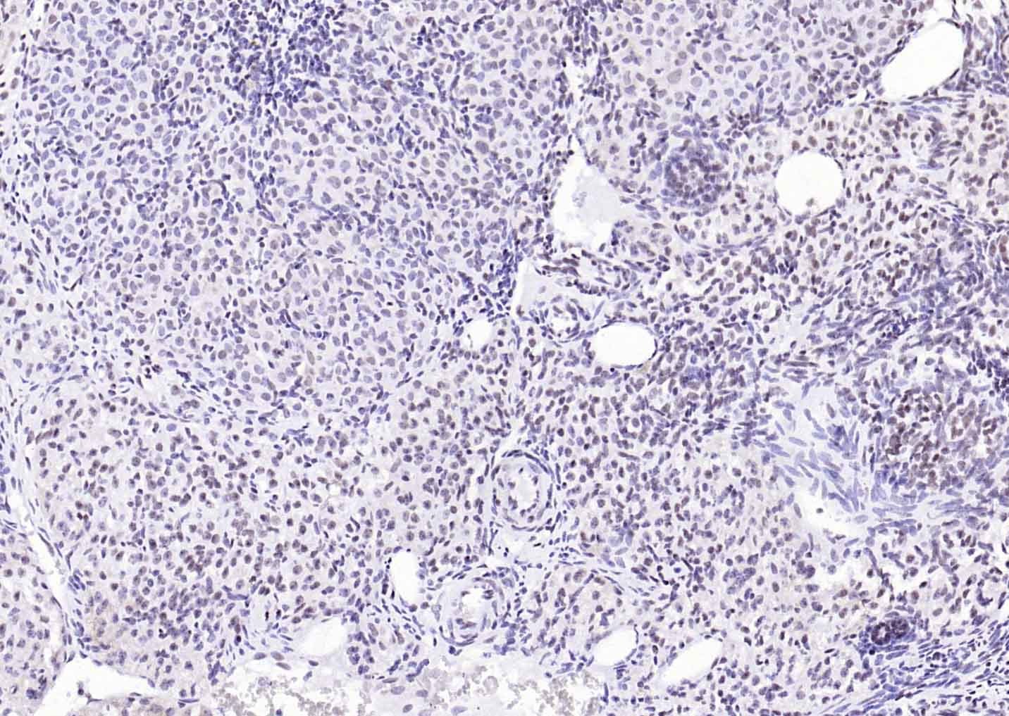 YY1 Nuclear Loading Control Antibody (3P967)