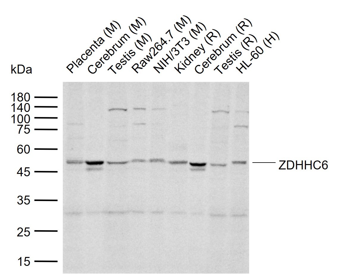 Anti-ZDHHC6 Polyclonal Antibody