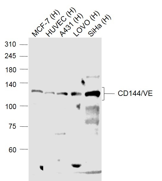 Anti-VE-Cadherin Polyclonal Antibody 2