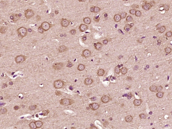 Anti-VEGFA Polyclonal Antibody 5