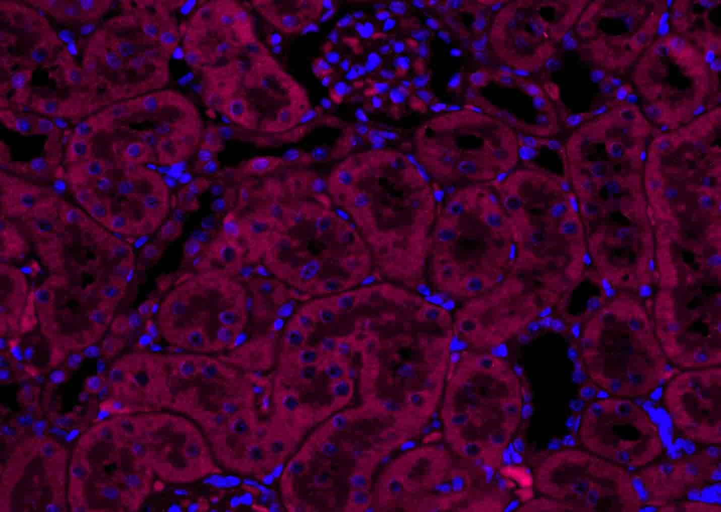 Anti-VEGFA Polyclonal Antibody 2