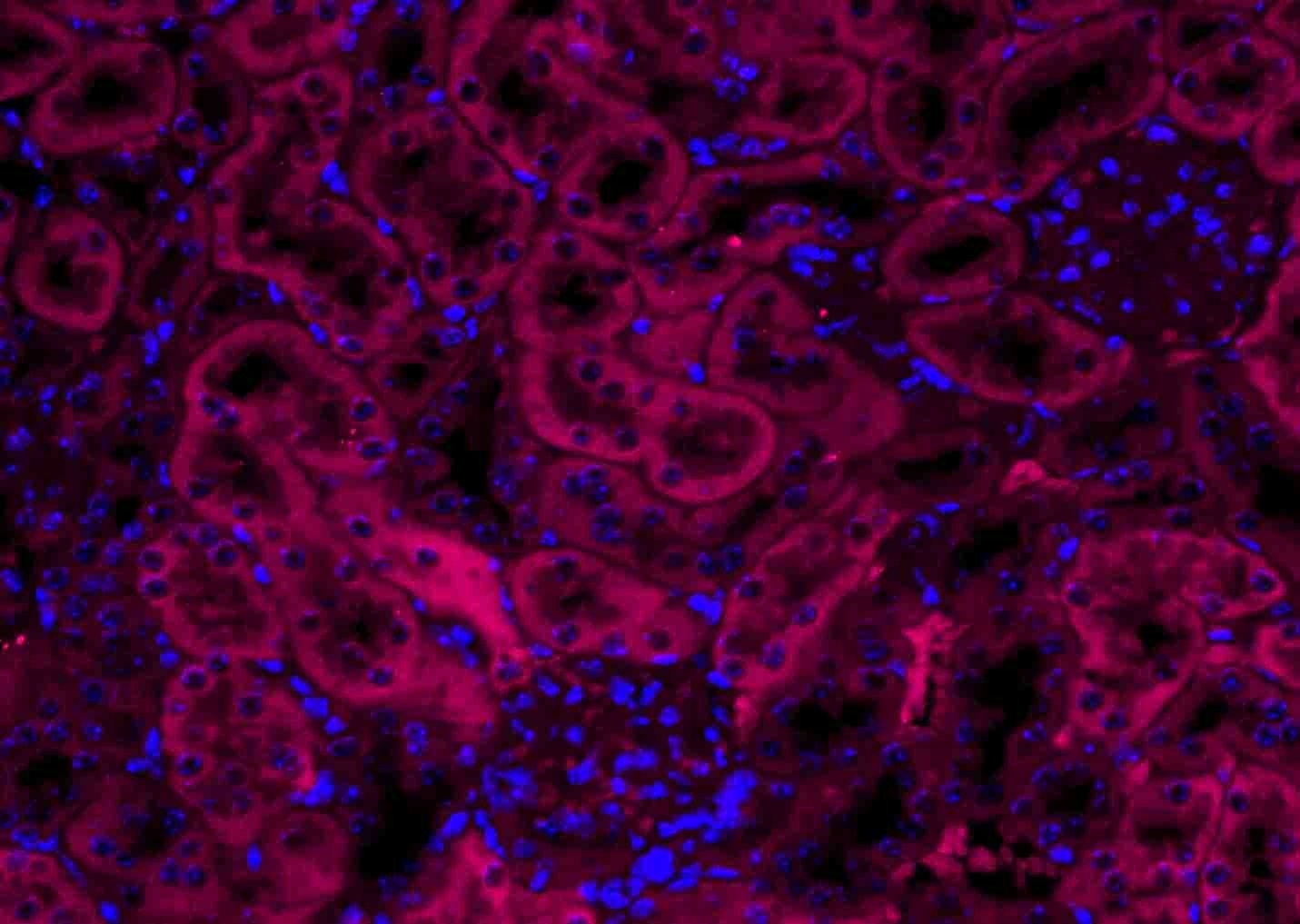 Anti-VEGFA Polyclonal Antibody 2