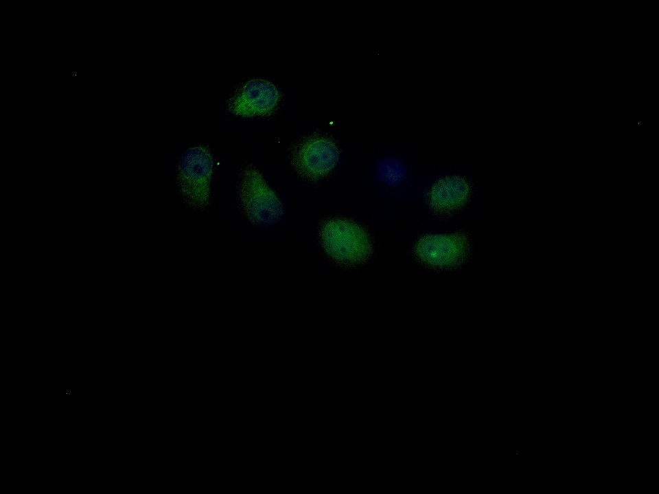 Anti-YAP1 Polyclonal Antibody